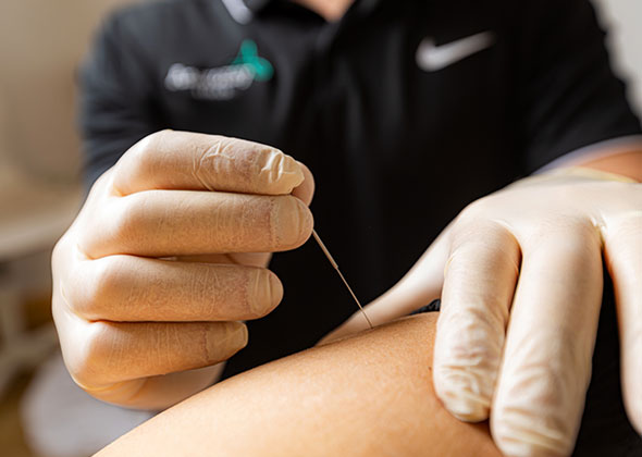 Dry-needling-and-physiotherapist